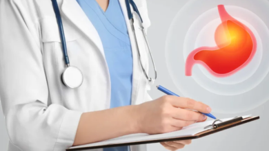 Common Myths in Gastroesophageal Reflux Disease (GERD)